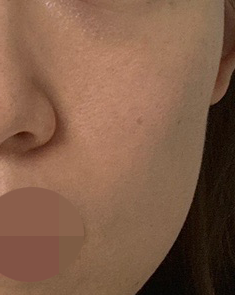 속건조랑 눈가 잔주름 때문에 받았는데 친절해서 좋았어요 ㅎㅎ