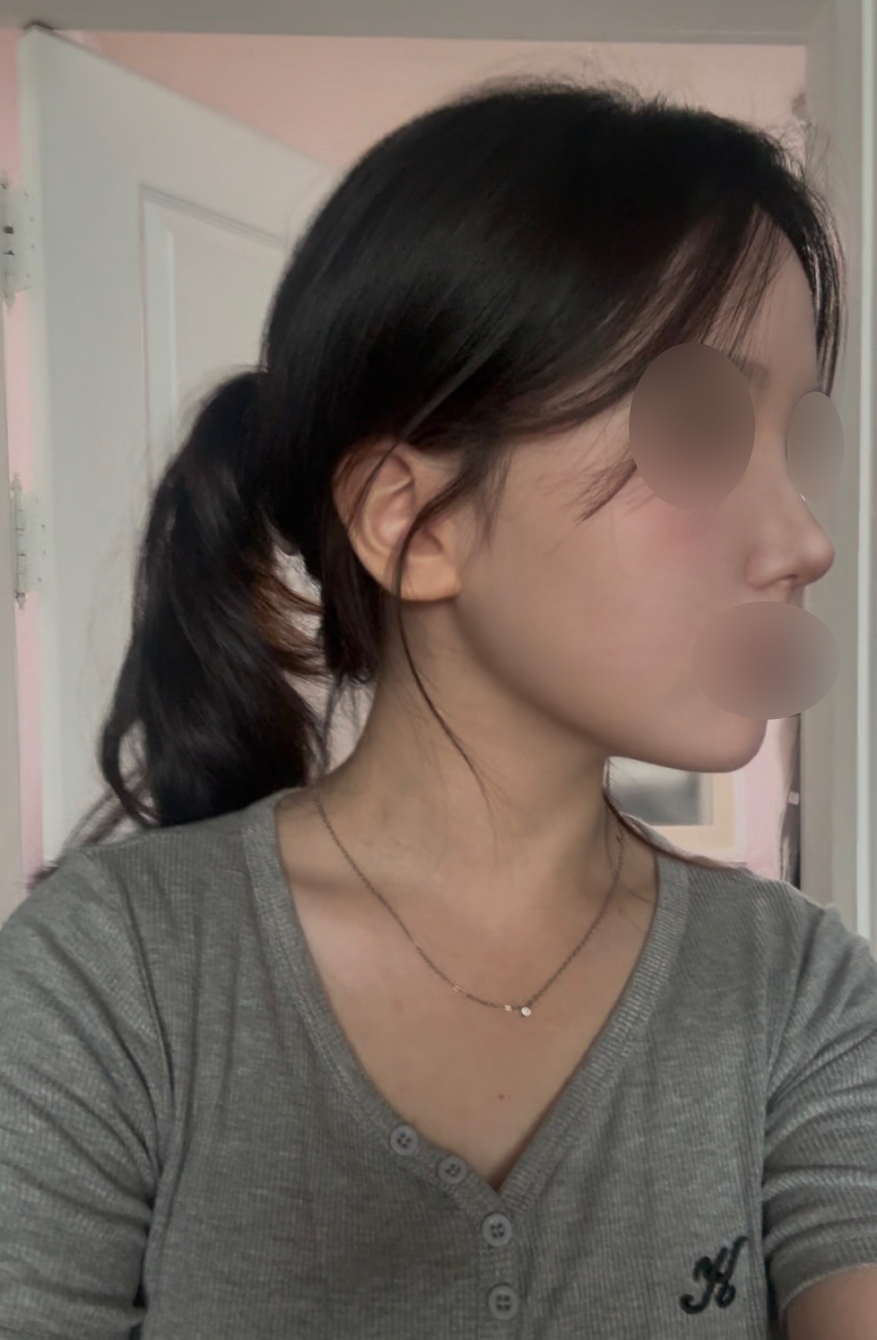 붓기 빠질 수록 만족감도 높아지고 자연스럽게 이뻐지고 있어요!