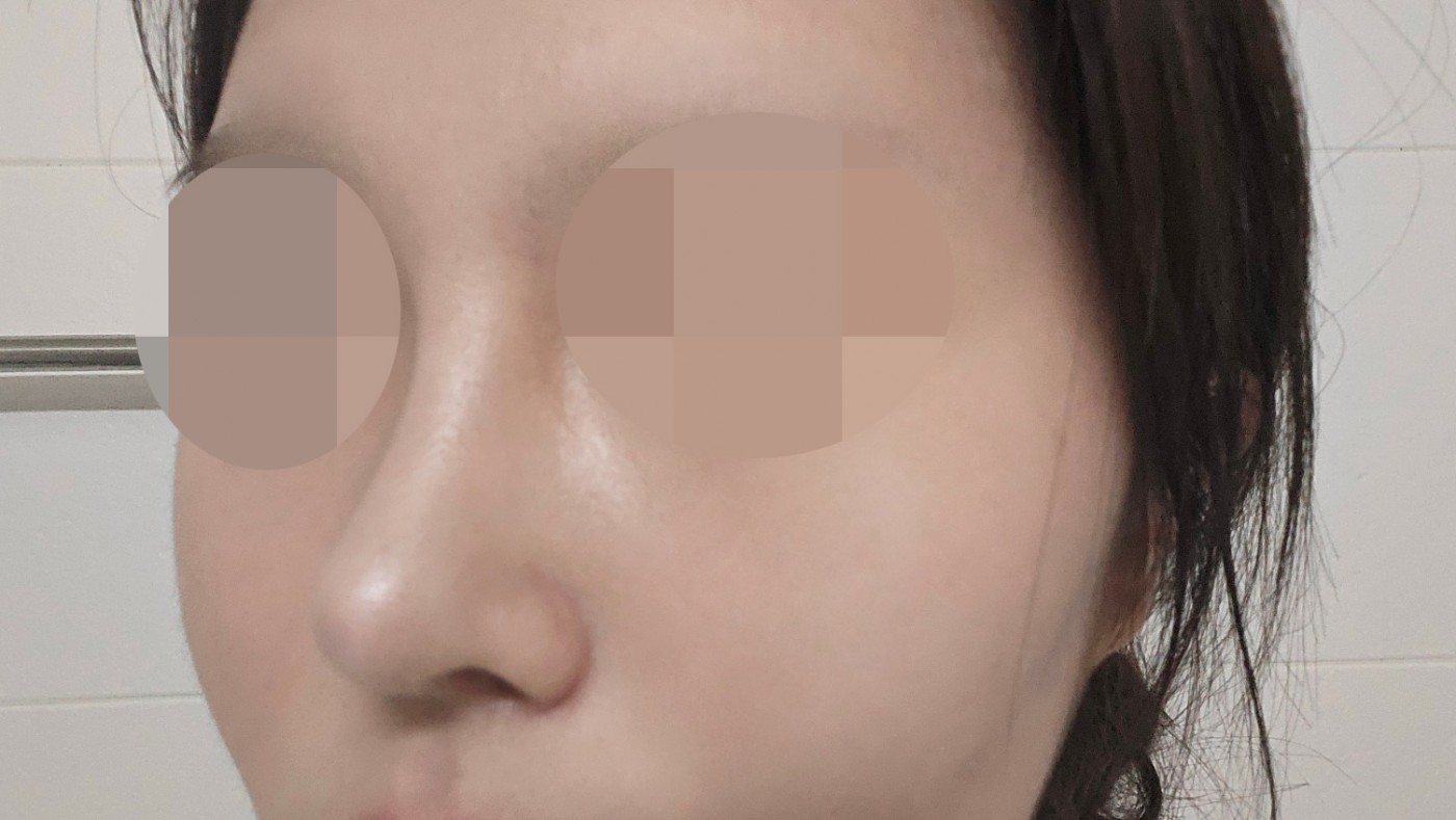 결과 만족스럽고 상담 시에 강요도 없고 필요한 수술로 잘 봐주십니다