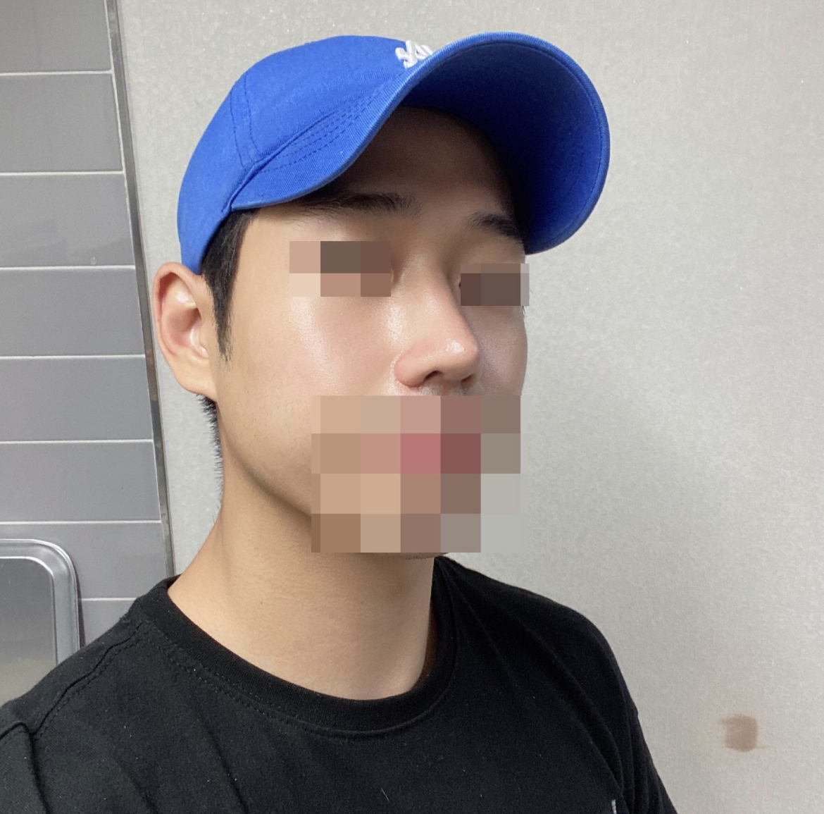 콤플렉스 탈출이요~!