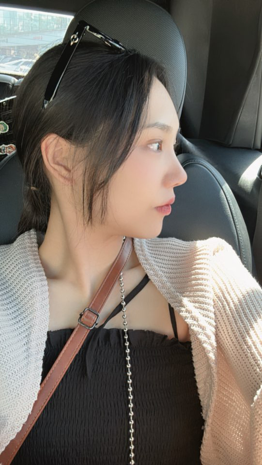 주변에서 자연스러운데 코 라인이 너무 이쁘다는 말을 많이 듣는중이예요 !!ㅋㅋㅋ