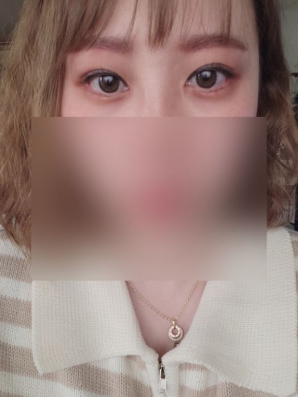 눈코 1달차 후기~~!