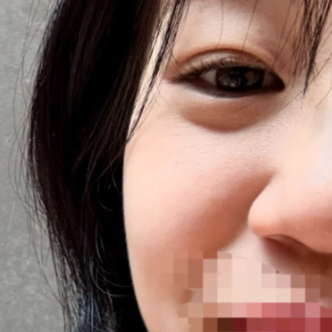 포텐자 당일, 수면으로 편안하게 받았어요 ^^
