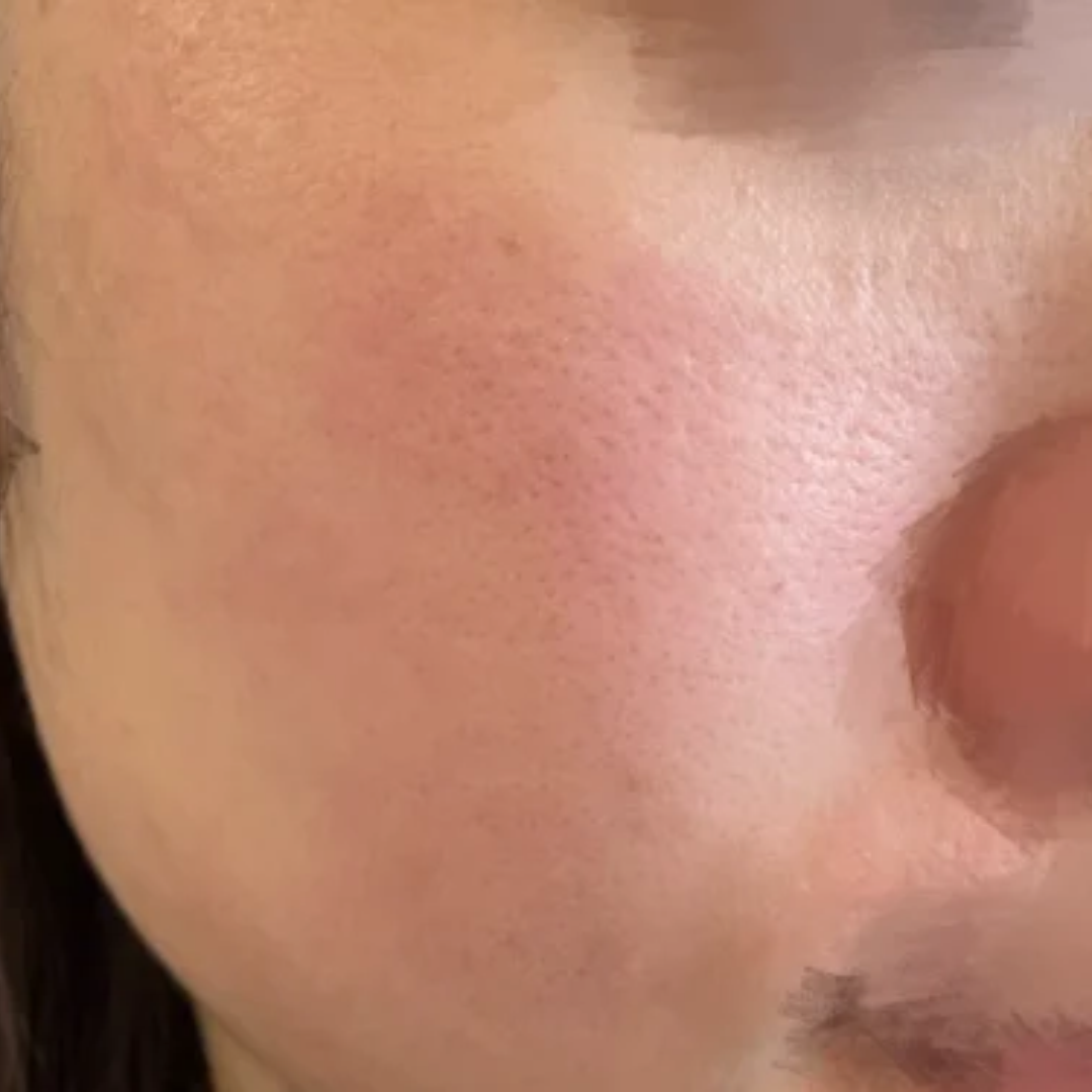맞춤 상담에 통증 부담까지 적었던 서울아이 쥬베룩 후기