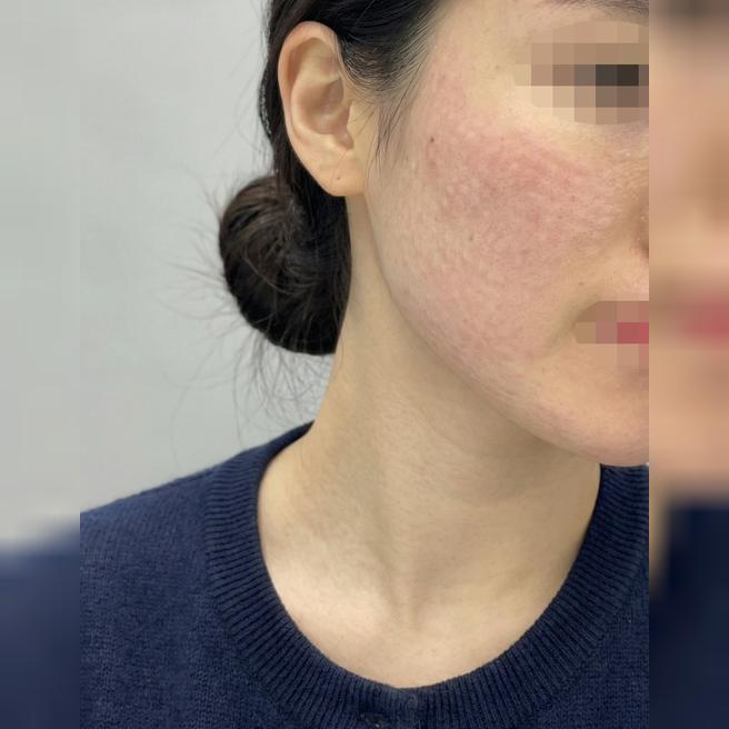엠보 확실하게 올라와서 또 재방문 할려고요!