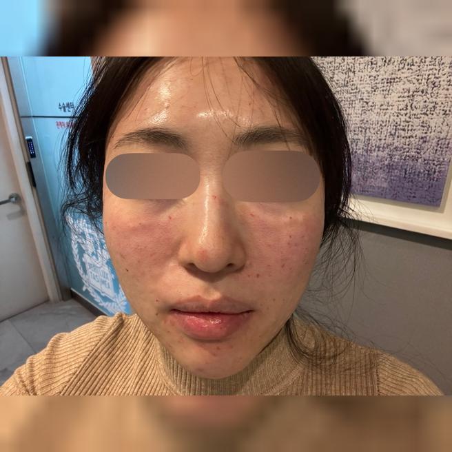 피부결 고민에 받아봤는데 상담부터 친절해서 좋았어요~