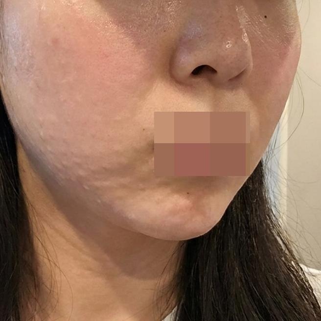 만족스러운 결과 덕에 재방문 확정인 리즈네 후기예요~