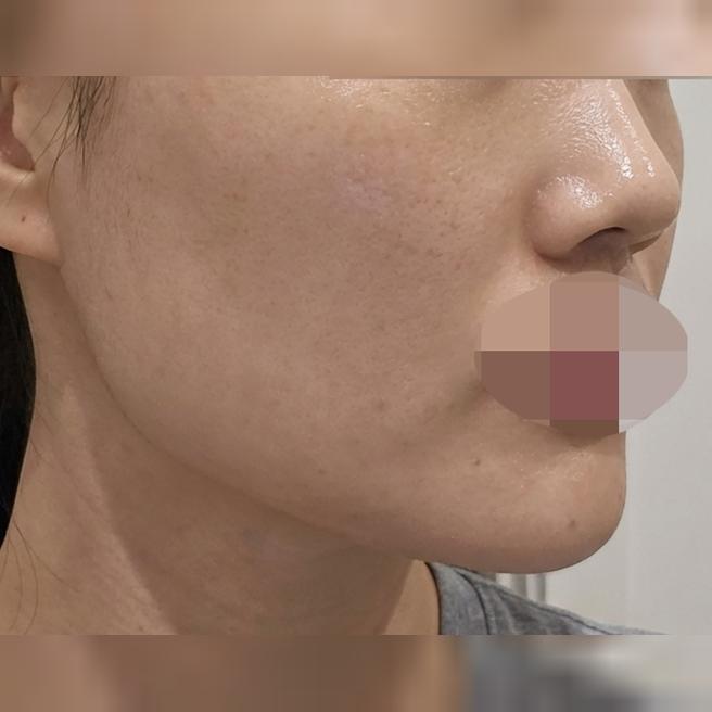 피부 컨디션 올리려고 쥬베룩 받았는데, 속건조가 잡혔어요!
