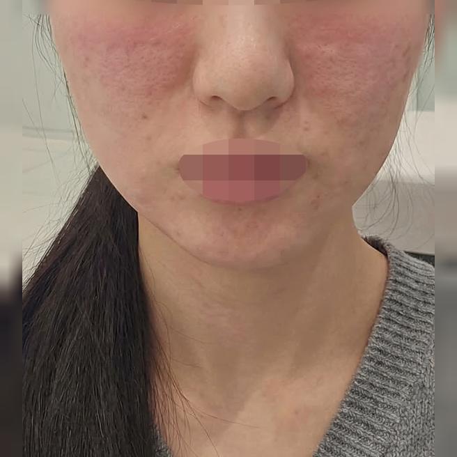 전에도 좋았는데 역시 피부 촉촉해져서 계속 다니는 것 같아요~