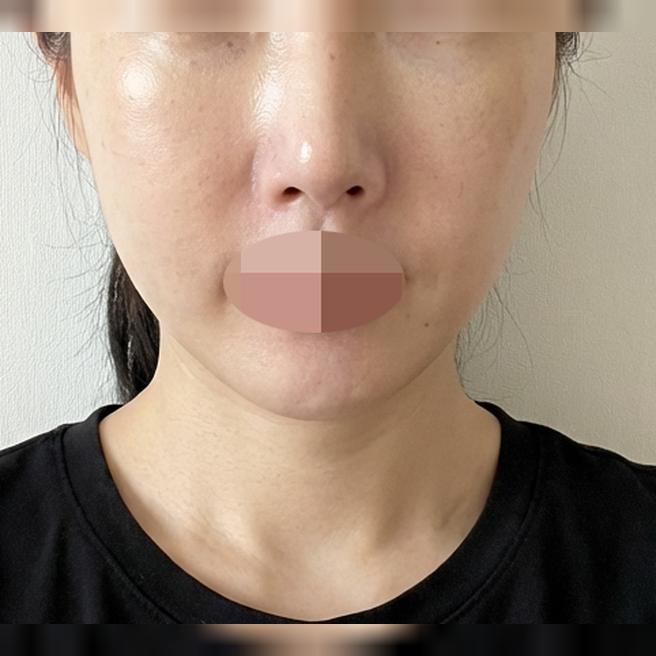 모공 사이사이 메이크업 뜨는 거 진짜 스트레스로 방문했습니다~