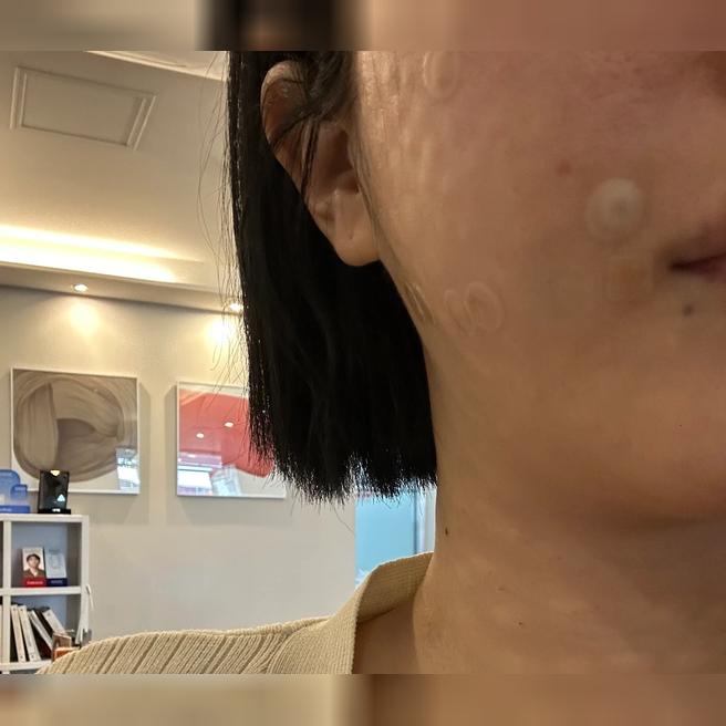 n년째 스킨부스터는 무조건 여기! 단골 정착한 후기예요~