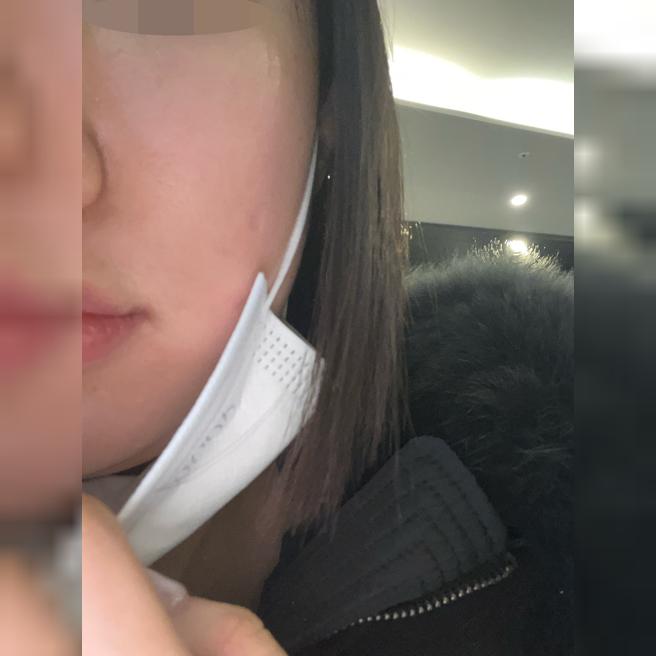 건조한 피부에 리쥬란 처방!! 재방문 예정입니다