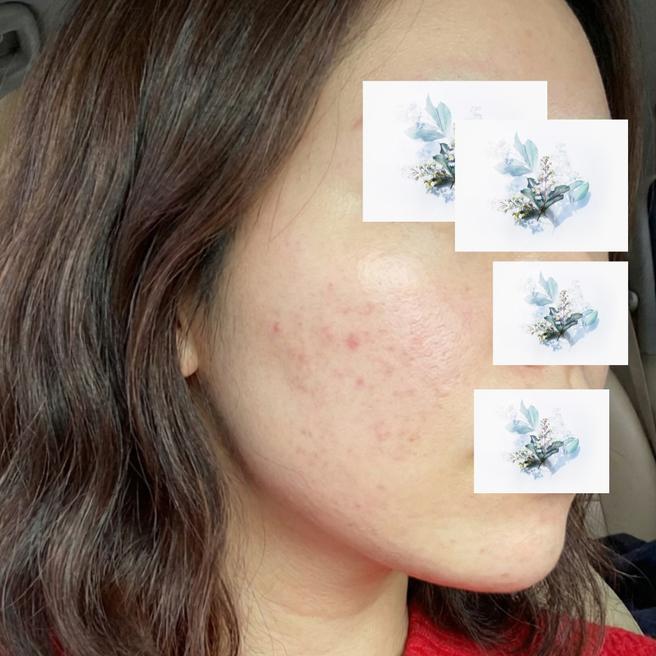 샤넬주사 드디어 받았어요! 기대 가득 당일 후기