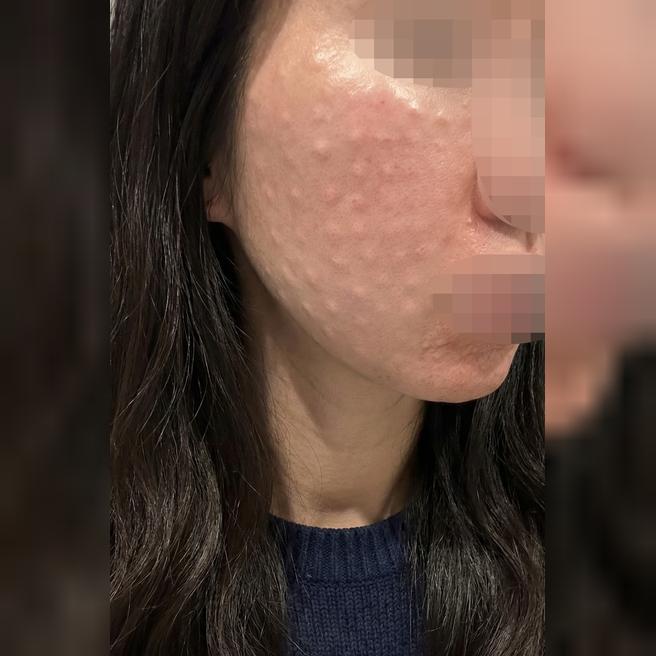 효과 좋아서 재방문했고 앞으로도 받을 예정입니다~