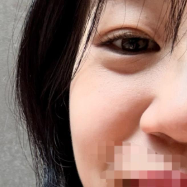 포텐자 당일, 수면으로 편안하게 받았어요 ^^