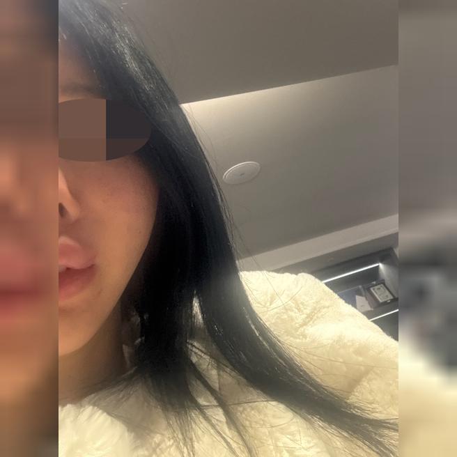 항상 받는 곳 에서 또 실리프팅 받고 왔어요~ㅋㅋ