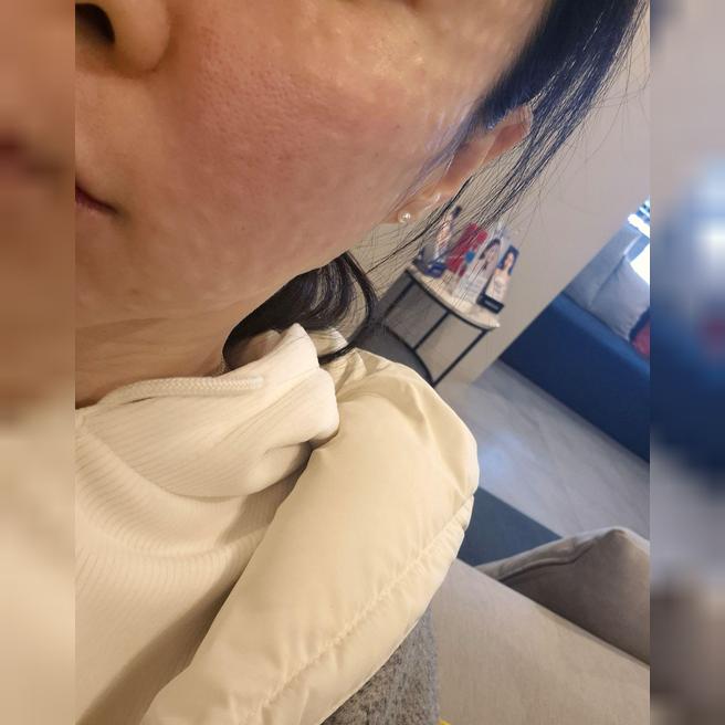 재방문 의사 200%! 친절하고 꼼꼼하게 잘 놔주는 곳 발견