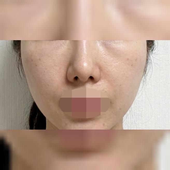 그늘져 보이던 눈밑, 확실히 채워진 느낌이에요~