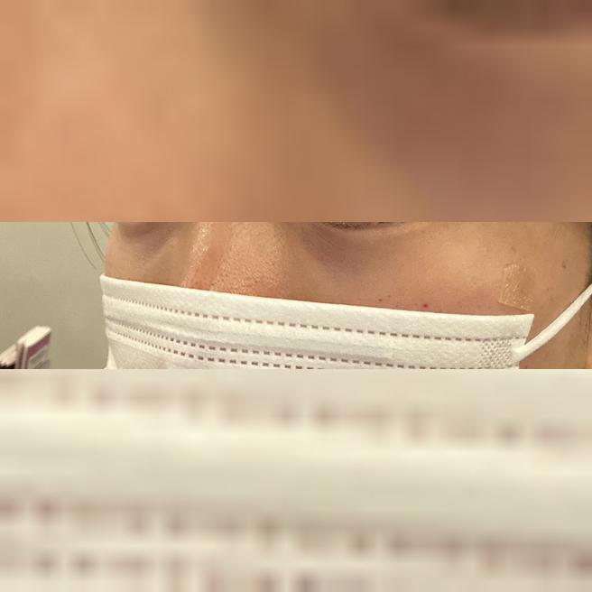 쥬베룩 아이 받고 왔는데 즉각 볼륨감 대박이에요