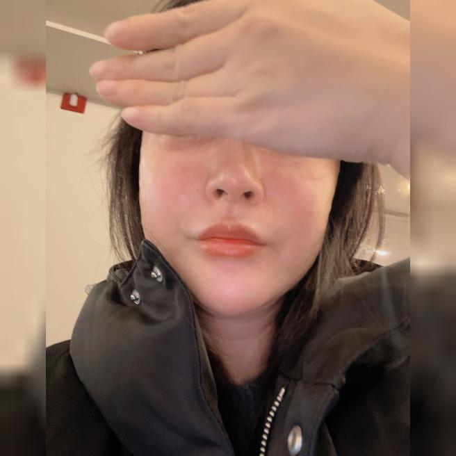 리쥬란 꼼꼼하게 잘해주셔서 계속 여기서 맞아요ㅎㅎ