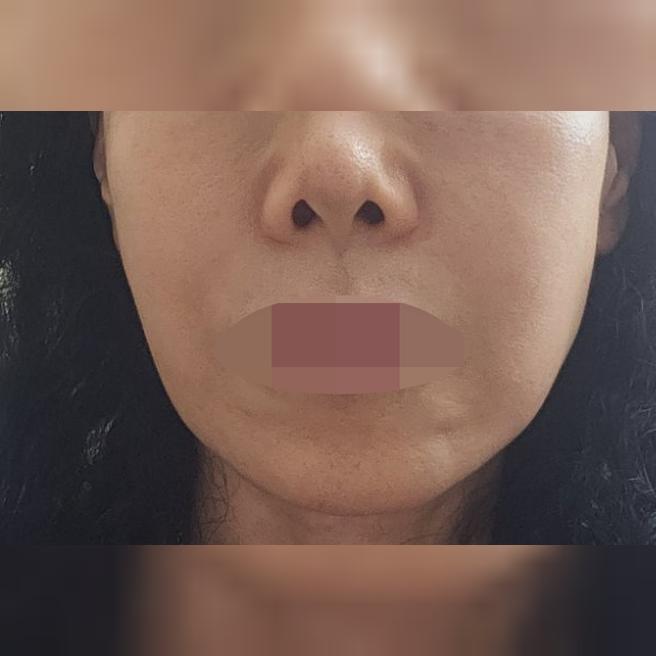딸이 추천해서 연어주사 받는데 효과 좋아서 단골이에요 ㅎㅎ