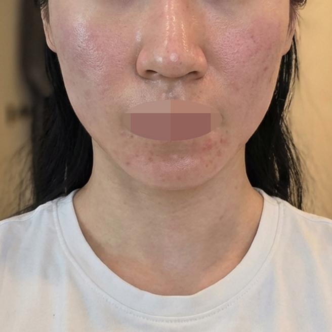 포텐자 받았는데 세안실도 있고 편해서 만족이에요~