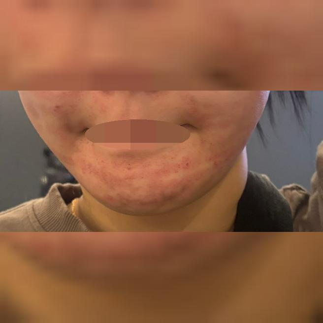 리쥬란 받았는데 가격 동일하고 좋았어요 ㅎㅎ