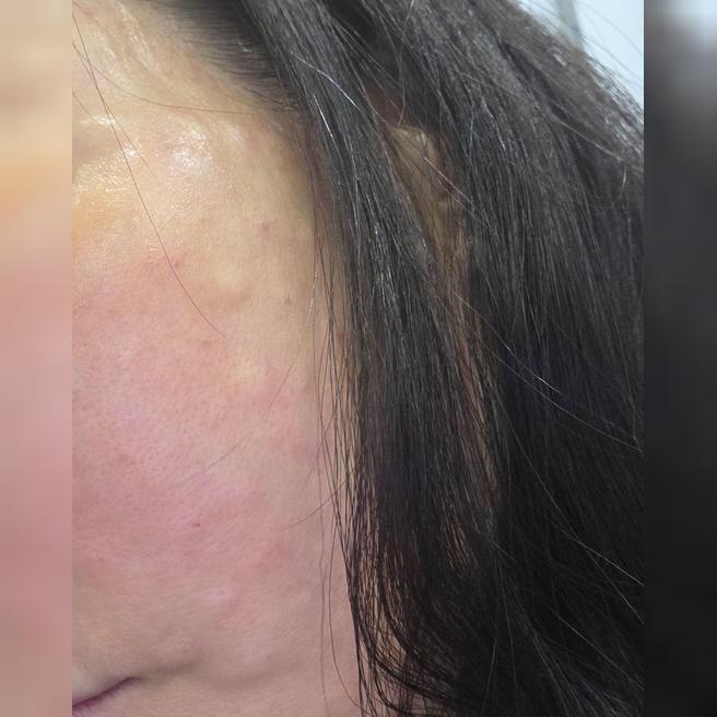 친절한 응대에 시술 결과까지 너무 만족해요~ 재방문 할 예정입니다ㅎㅎ