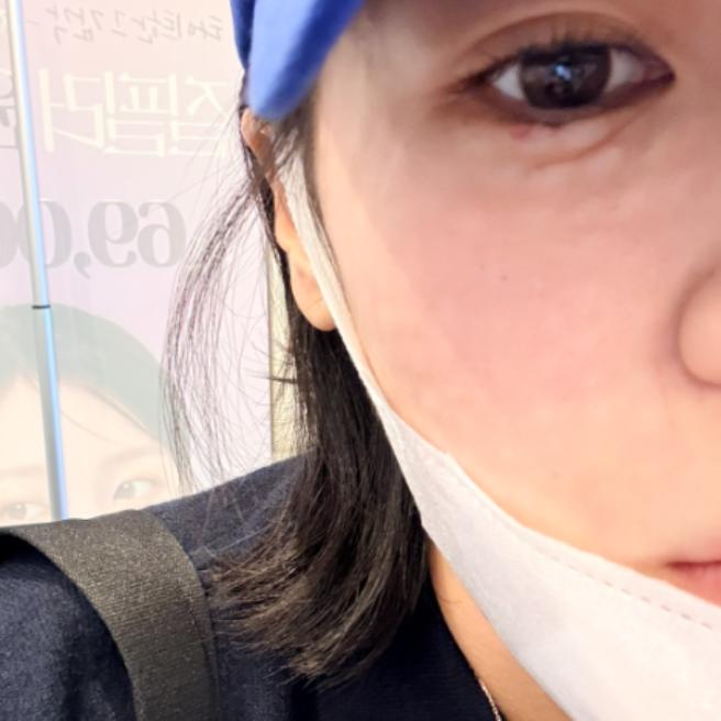 리쥬란 당일 후기, 수면으로 편안하게 받고 꼼꼼한 시술에 만족해요!