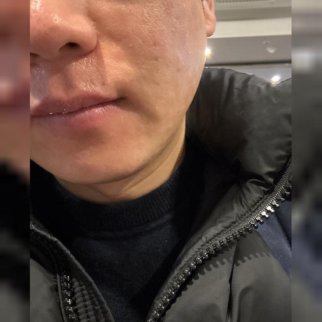 나이 들어서 시술 시작했는데 편하게 받았습니다~