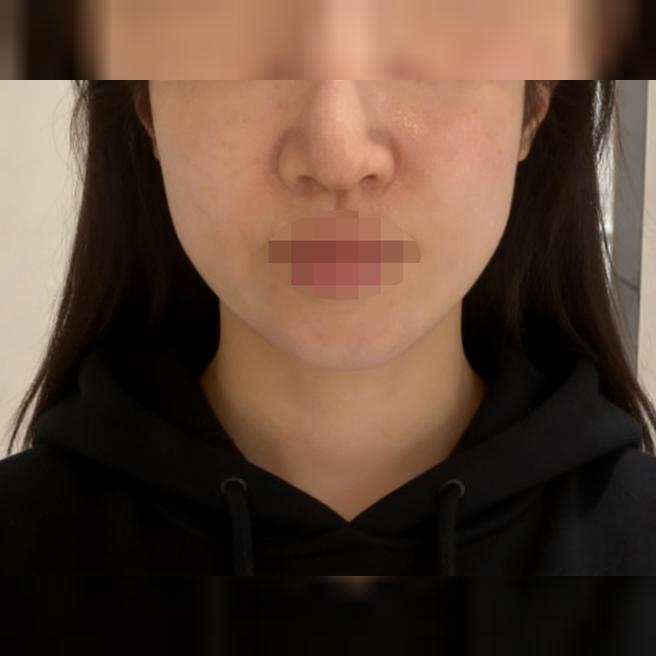 피부가 예전 같지 않아서 왔는데 하루 지나니까 좋은 느낌이에요 ㅎㅎ