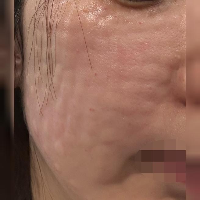 정품인증 확인시켜주시고 코드도 주셔서 믿음이 가요! 다음엔 리쥬란 또 받아보려고요ㅎㅎ