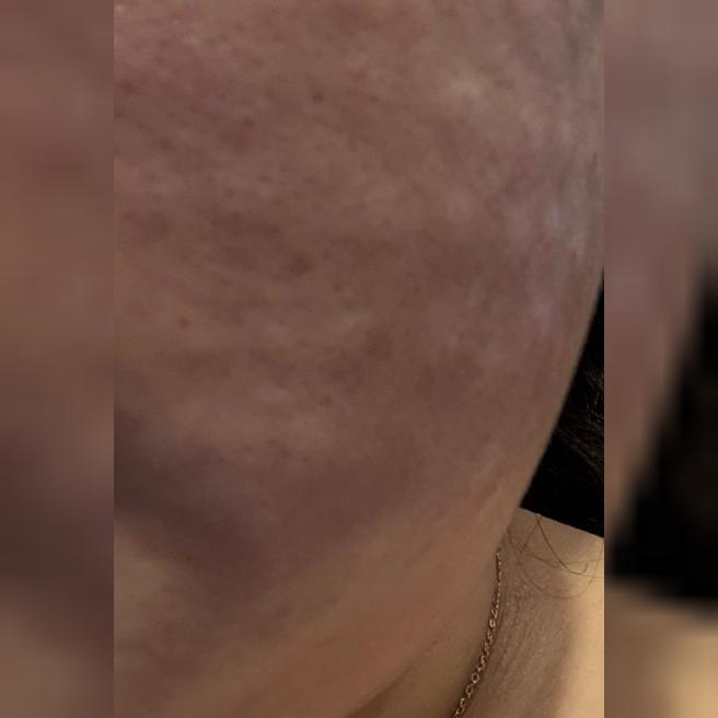 친절한 응대 덕분에 리쥬란 편하게 받아봤어요ㅎㅎ