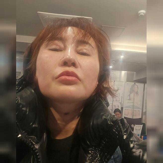 목주름 + 온다리프팅 맞고 왔어요! 매달 관리 예정