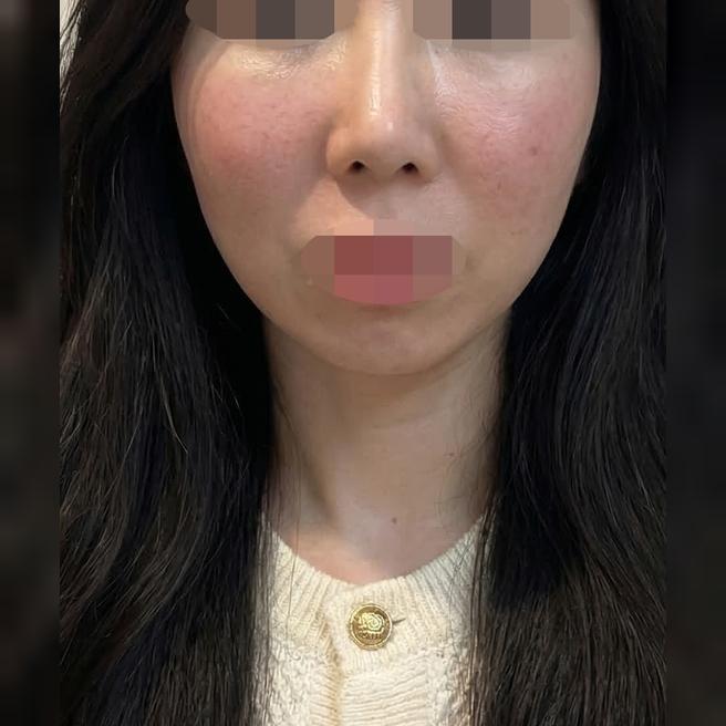 LDM 받았는데 친절하고 대기 없어서 안심하고 받았어요 ㅎㅎ