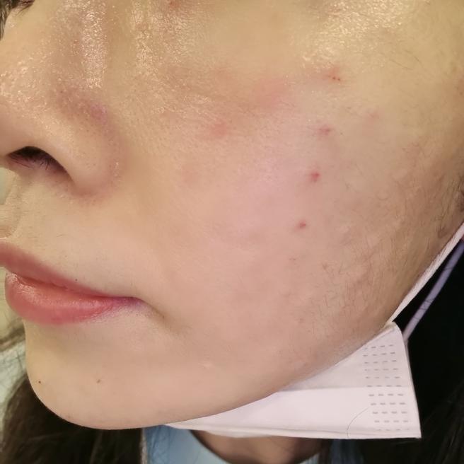 여름철 모공이랑 과잉피지 고민으로 쥬베룩스킨 받아봤어요~