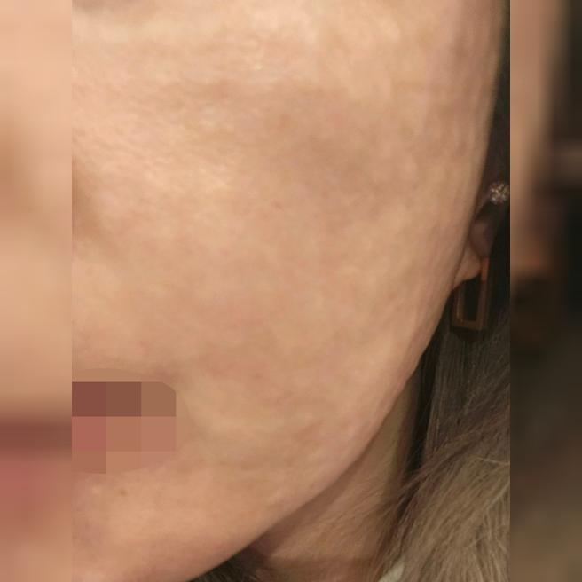 엠보 촘촘하게 잘 올라와서 다음에도 여기 오려고요!