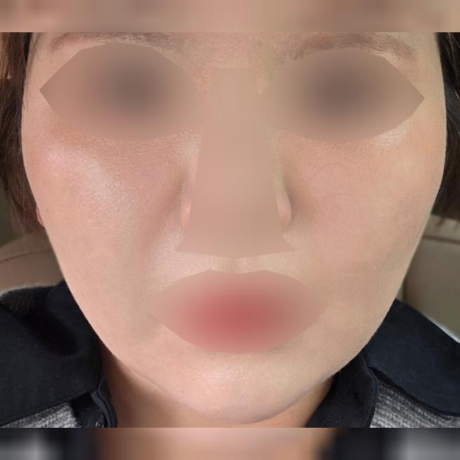 환절기 푸석함 때문에 왔는데 가격도 동일하고 빠르게 진행돼서 좋아요 ㅎㅎ