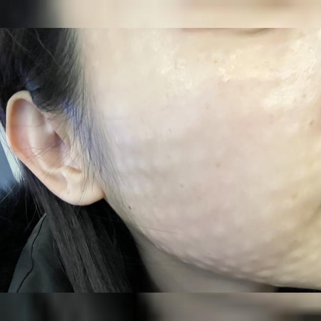건조함이랑 재생력 때문에 왔는데 꼼꼼하게 해주셔서 만족이에요~