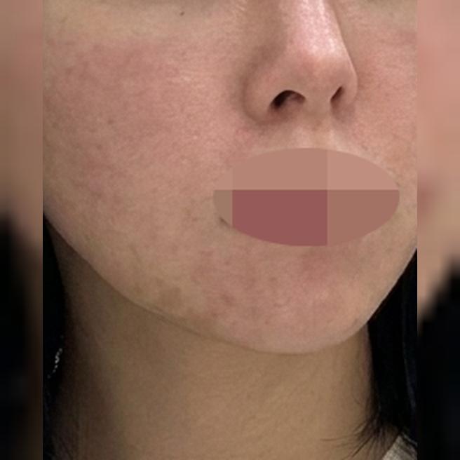 모공이랑 화장 들뜸 고민, 포텐자로 잡으러 다녀왔어요!