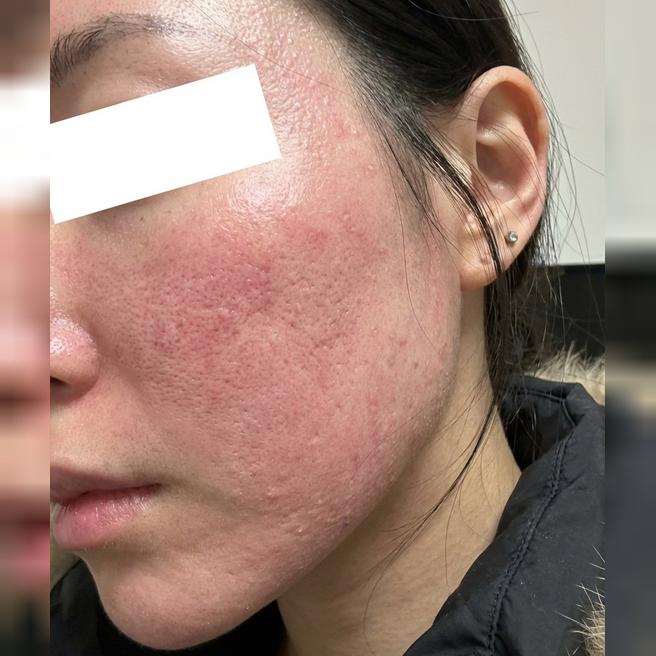 늘 애용하는 병원이에요~ 상담부터 시술까지 다 꼼꼼해요!