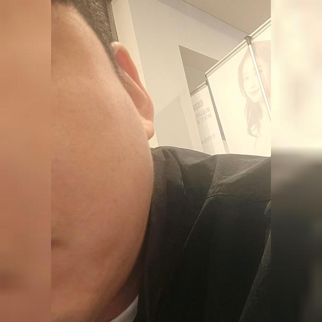 결혼 앞두고 울쎄라 받았는데 과잉진료 없고 친절해서 좋았어요.