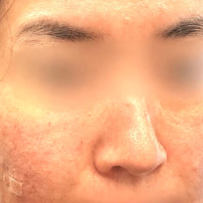 레디어스 당일, 대기 없이 만족스러웠던 첫 방문