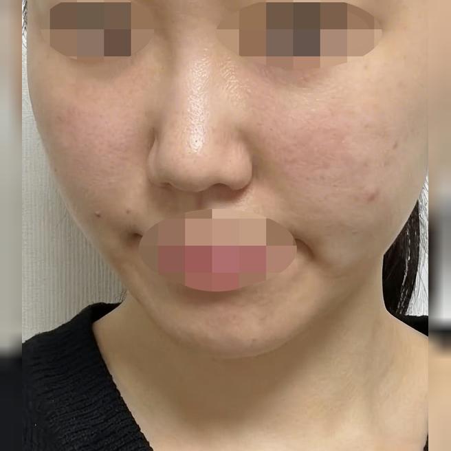쥬베룩이랑 온다 같이 받았는데 라인 정리 효과 바로 나타나요 ㅎㅎ