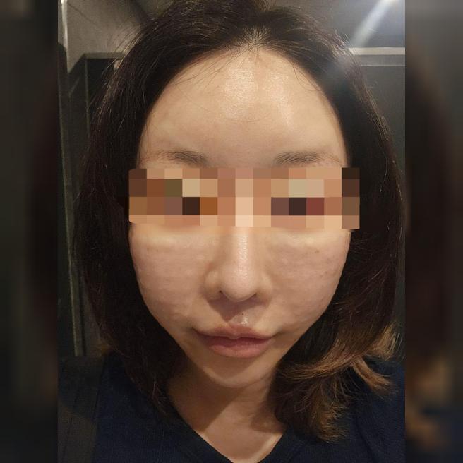 친절하고 신속한 리쥬란, 효과가 벌써 기대됩니다