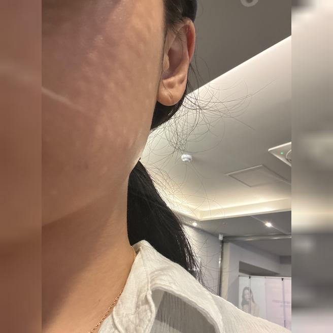 효과 확실한 리쥬란 단골, 이번에도 만족스럽게 받았어요!