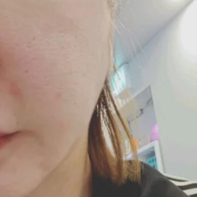 포텐자 시술 후기, 원장님 실력부터 친절함까지 대만족!