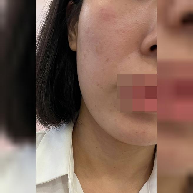 일상 복귀 빠른 쥬베룩, 꾸준히 받기로 결심했어요