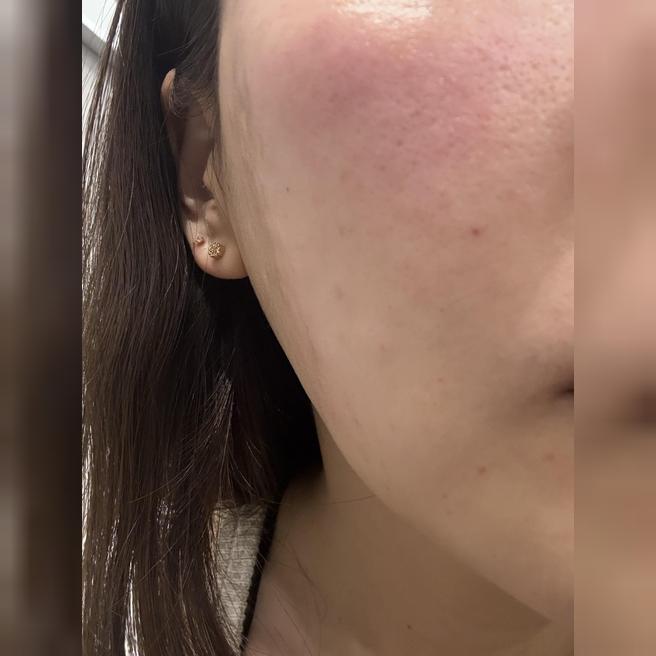 화장 안 해도 될 정도로 효과 좋아서 2차 재방문했어요!