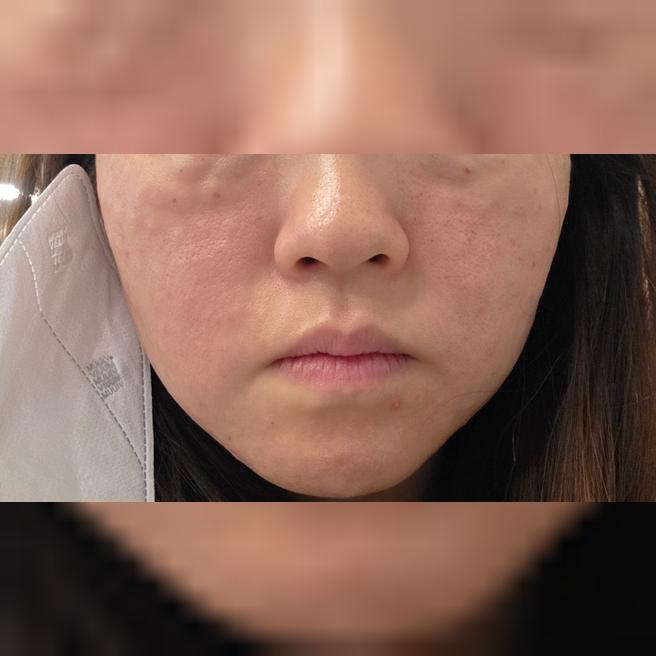 본식 앞두고 속건조 관리 받고 왔어요~